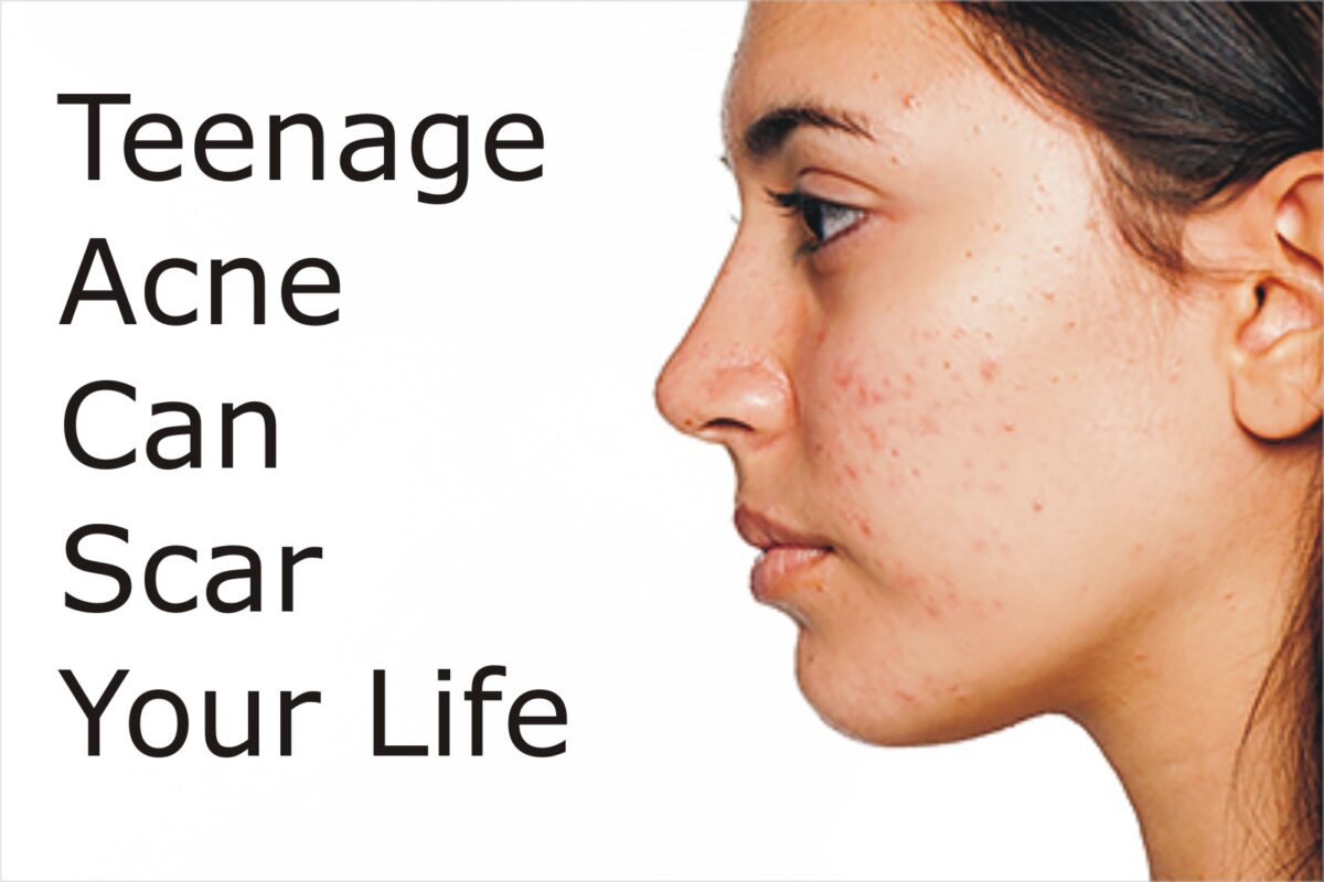 How To Get Rid Of Teen Acne - Dr. Health Clinic - Homepage