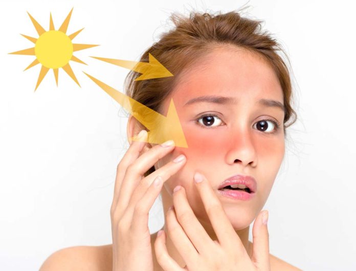 How To Remove Sun Tan and Dark Spots From Your Skin?