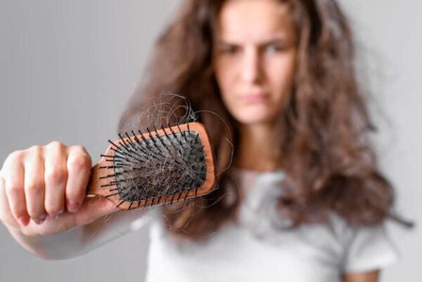 Hormonal hair loss – Causes and Solution