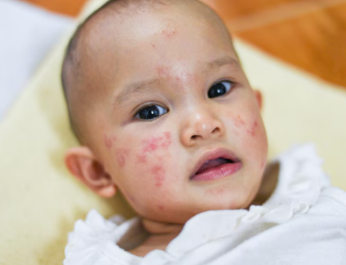Understanding Common Skin Problems in Infants and How to Manage Them